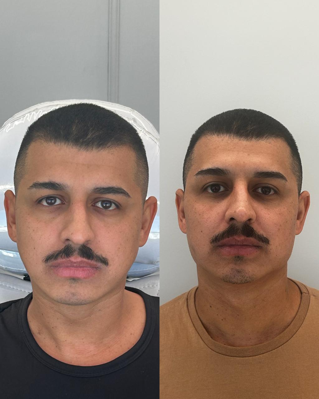 Resultado 3
